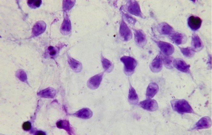 Лямблия кишечная под микроскопом